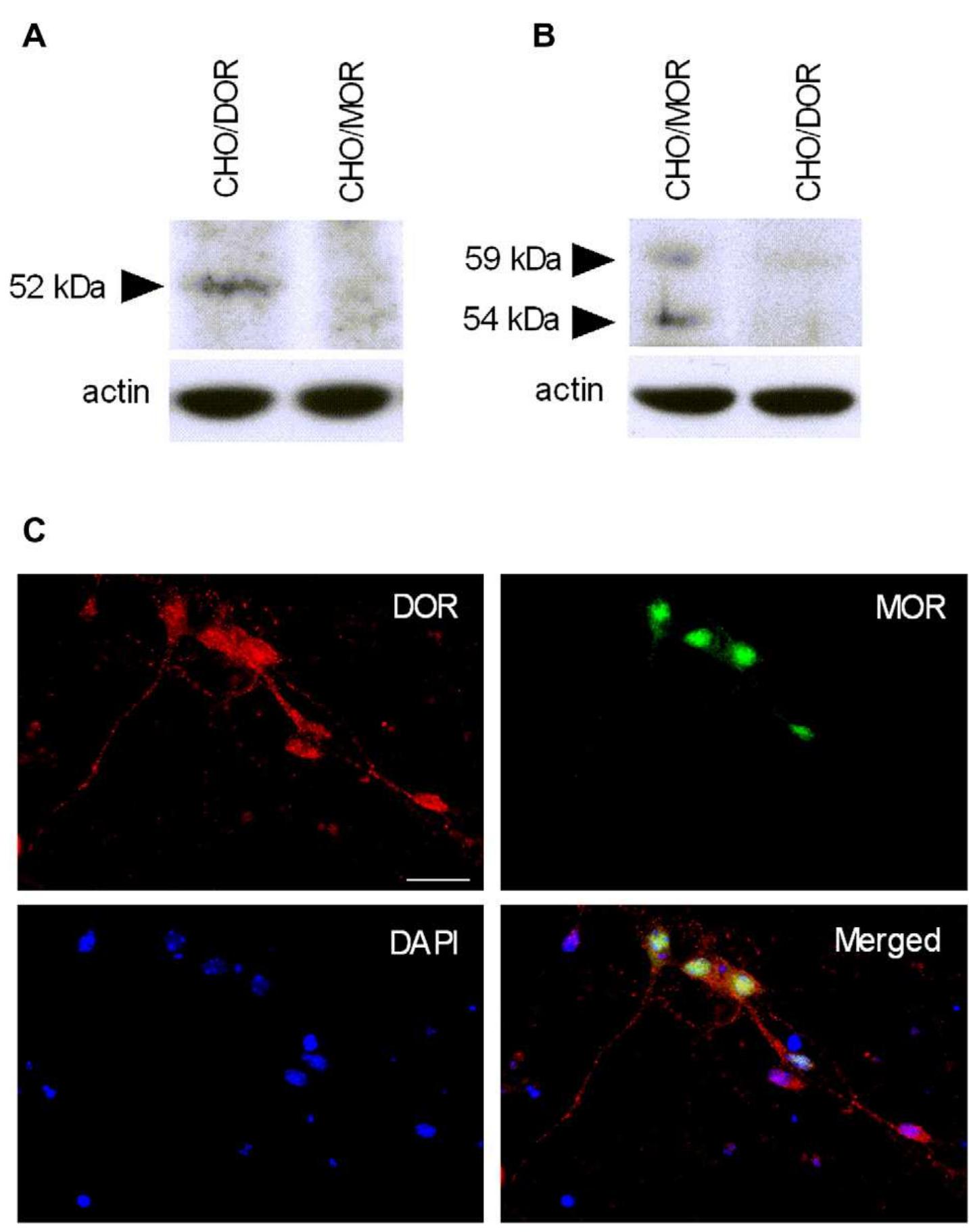 Double immunofluorescence labeling of da d1 receptors, 5-
