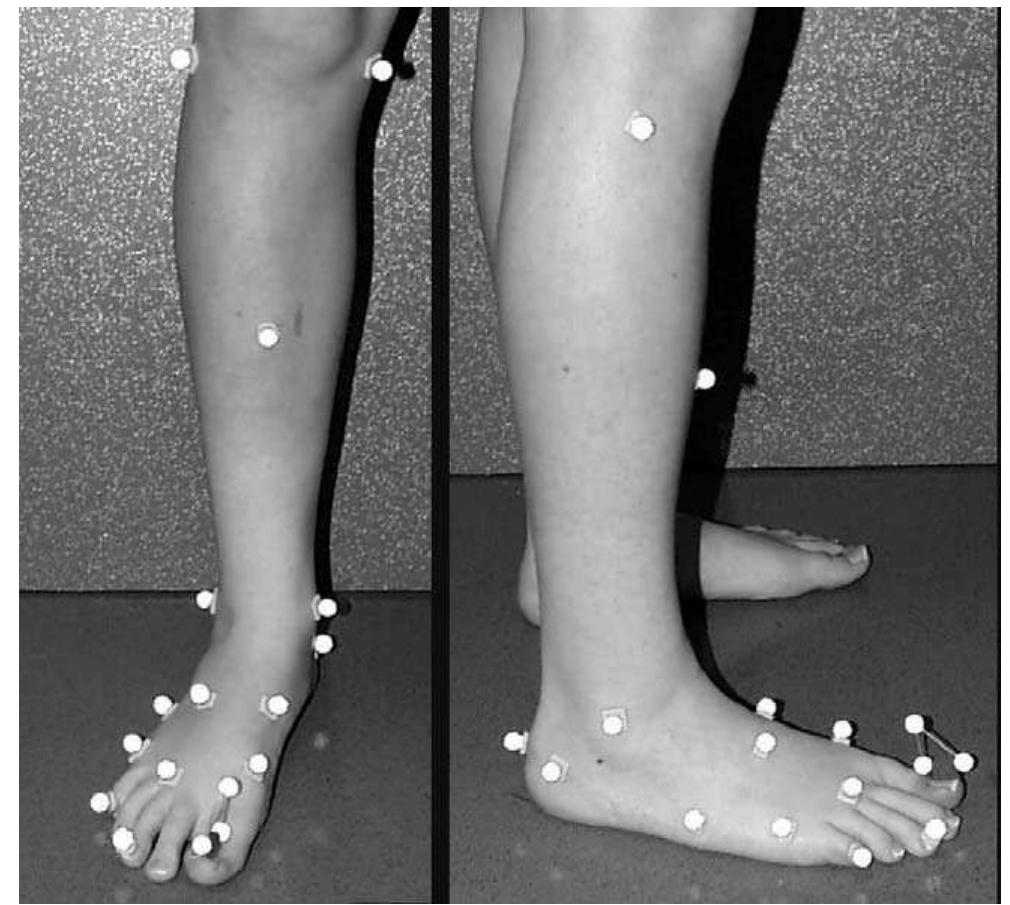 Figure 1 - from Foot kinematics and kinetics during