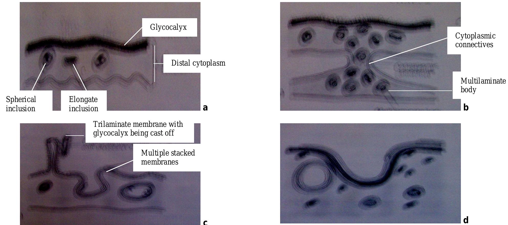 Microtrichae Insects Microtriches. a, diagram illustrating the typical ultra