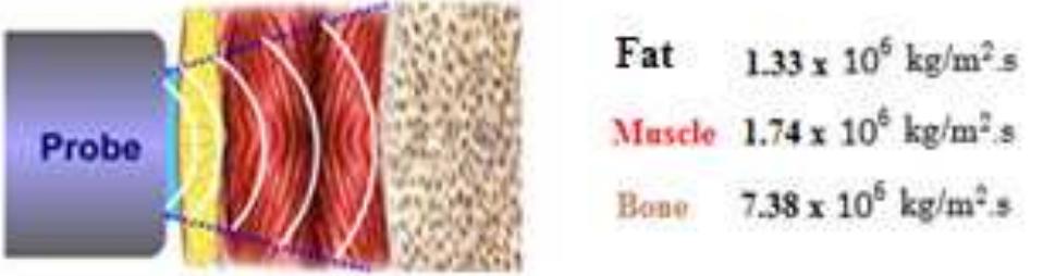 Fat/muscle/bone interface (taken from ref. [16]). case 3: