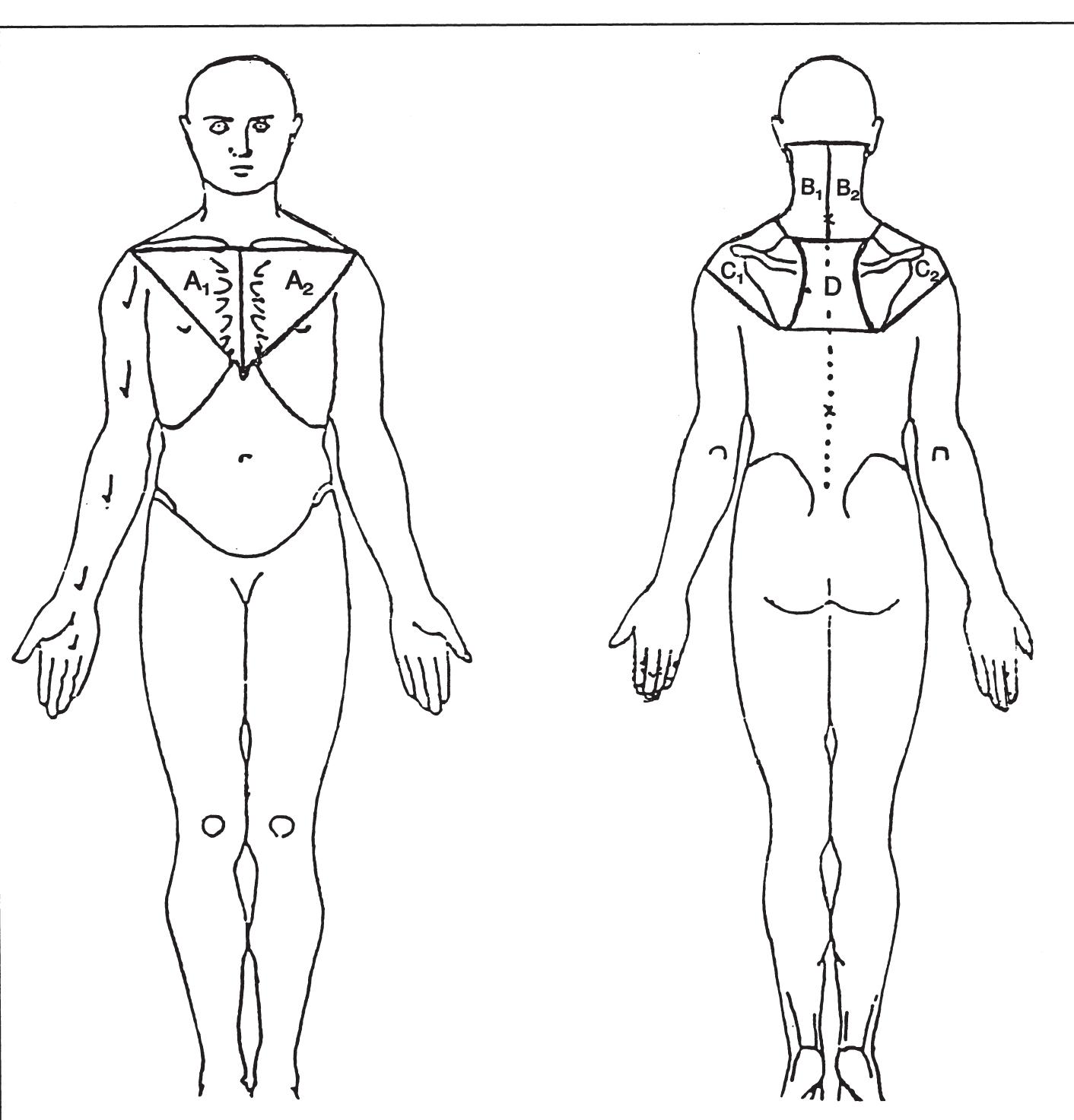 Body diagram used in conjunction with the pain questionnaire