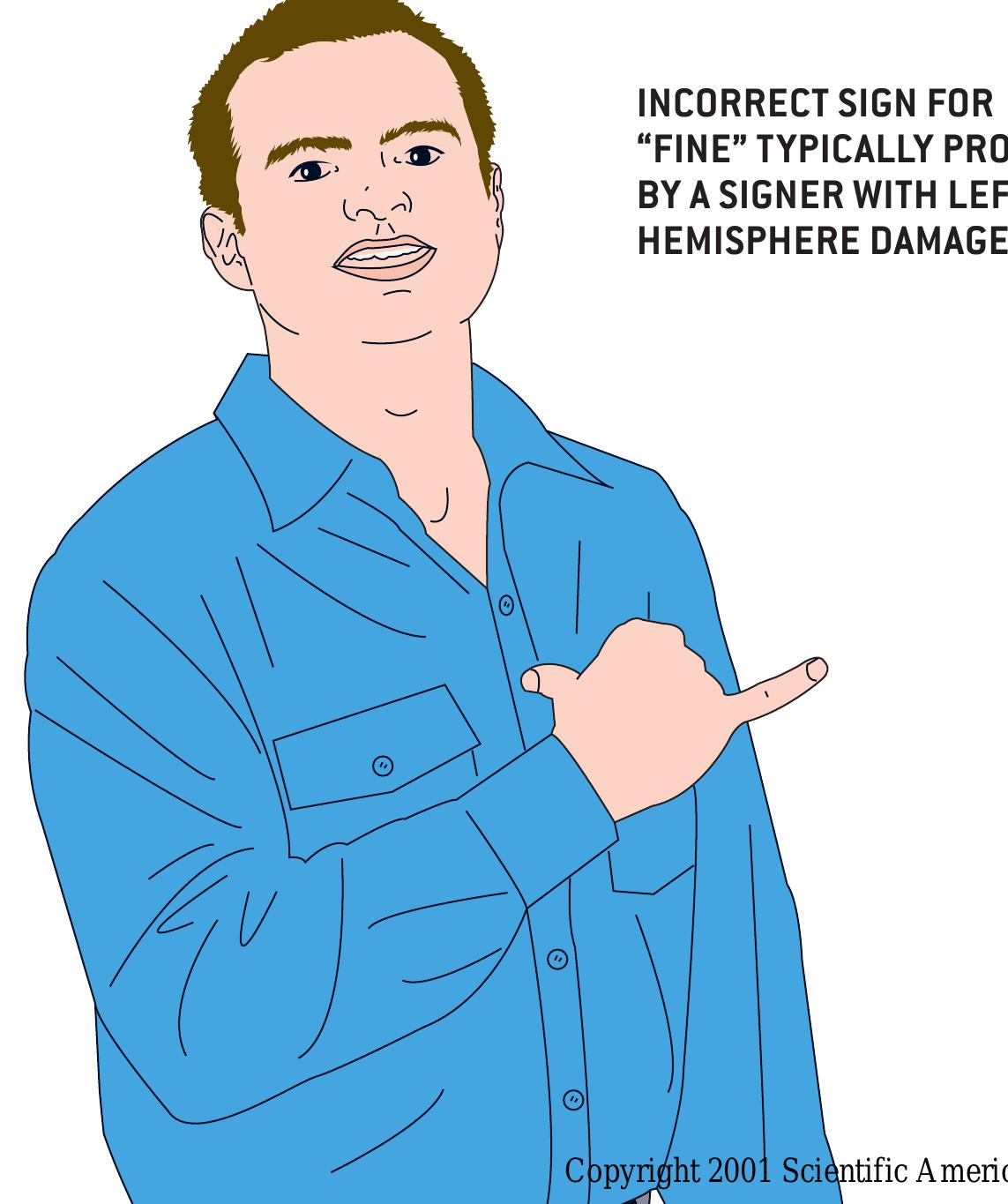 (PDF) Sign language in the brain