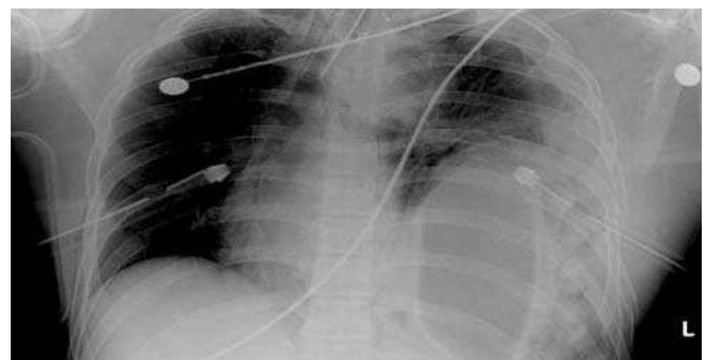 【Fukuda】 PDF) International Surgical Week ISW 2009 159