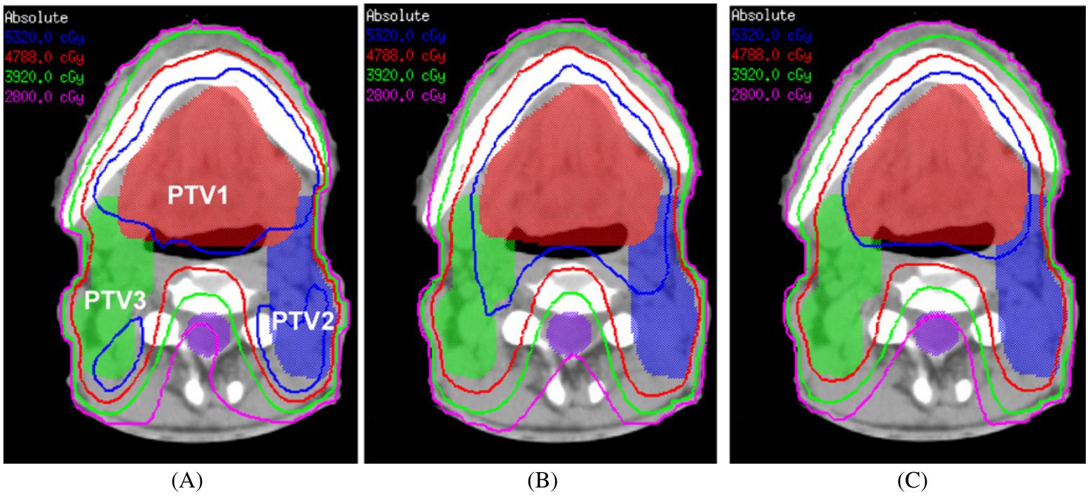 Figure 10 - from Comparison of anatomy-based, fluence-based