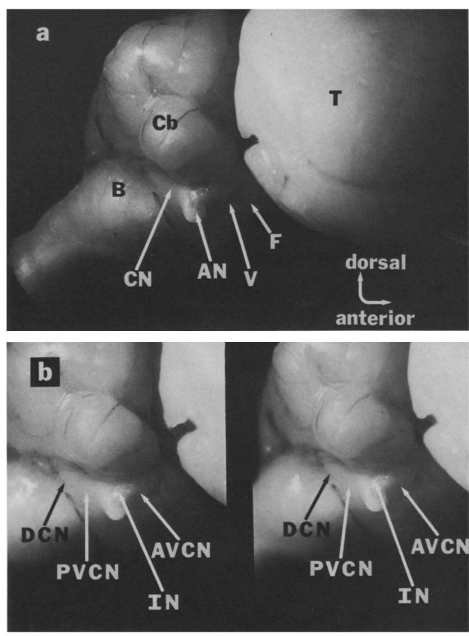(PDF) Anatomy and physiology of the gerbil cochlear nucleus: An ...
