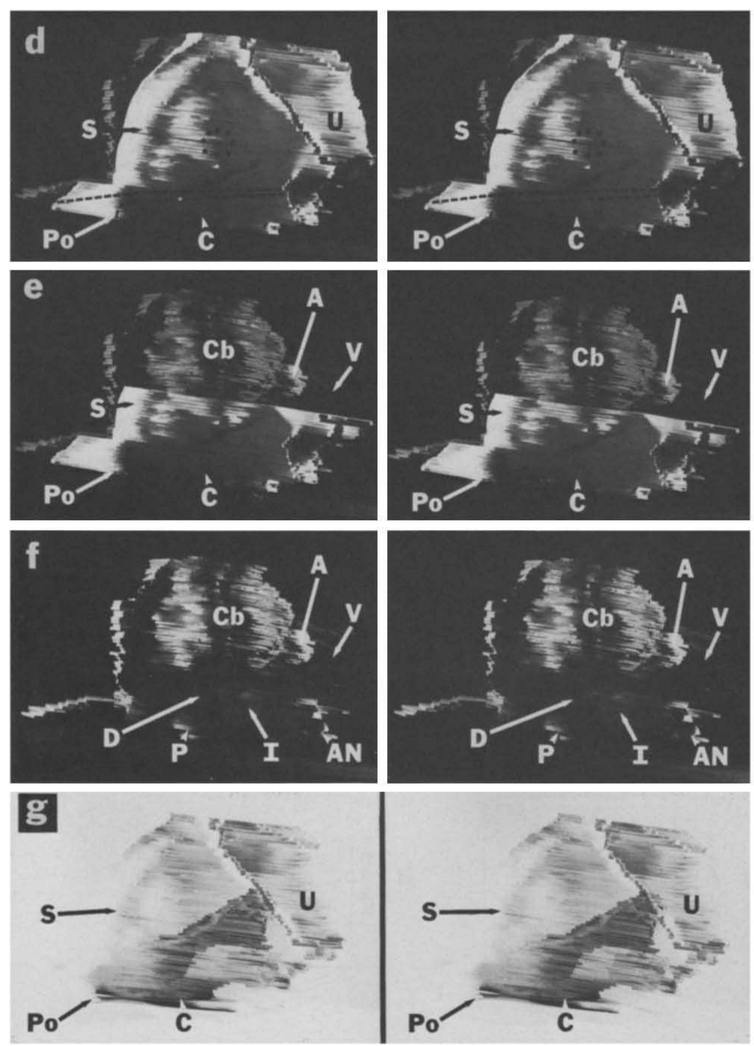 (PDF) Anatomy and physiology of the gerbil cochlear nucleus: An ...