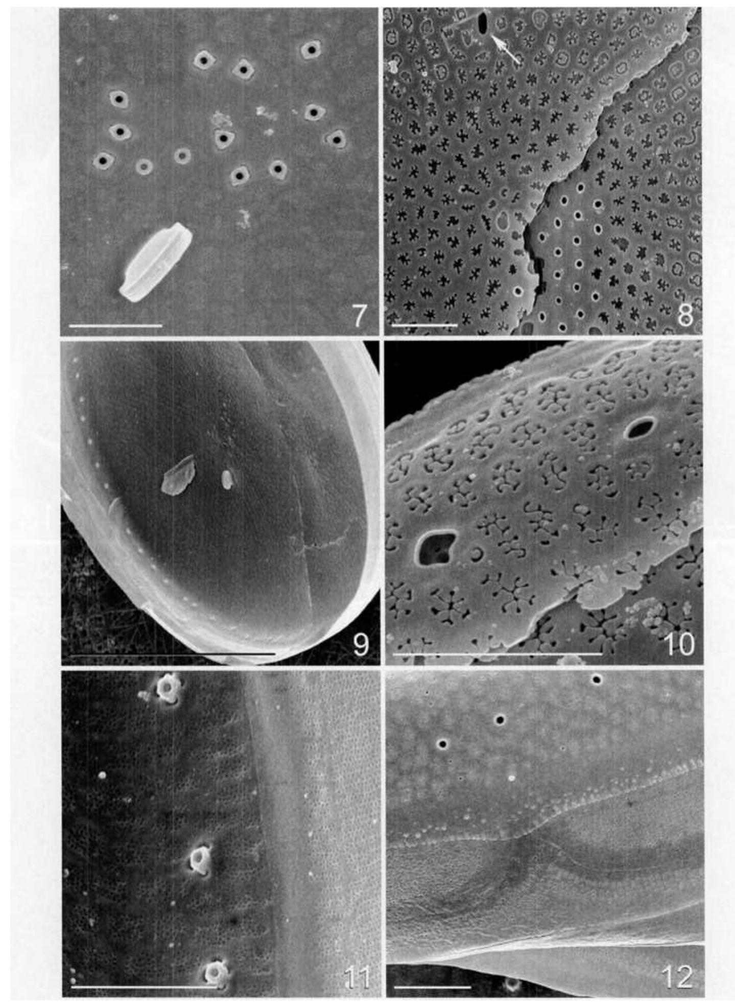 Strutted Processes (PDF) CELL WALL MORPHOLOGY AND SYSTEMATIC IMPORTANCE OF THALASSIOSIRA ...