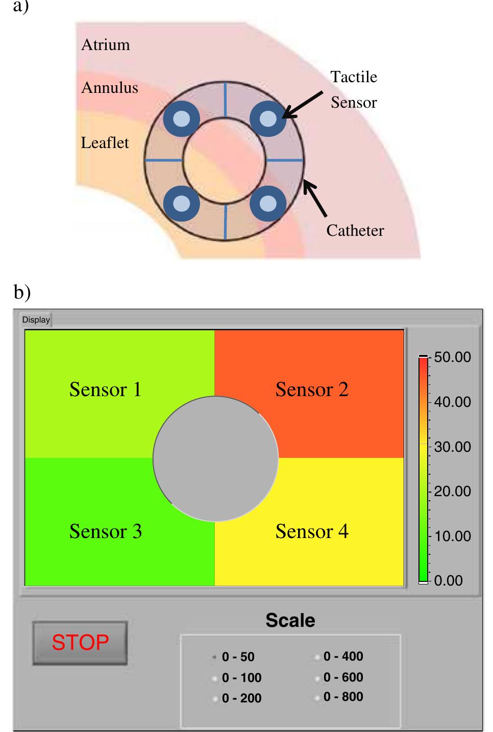 PDF) A piezoresistive tactile sensor for tissue