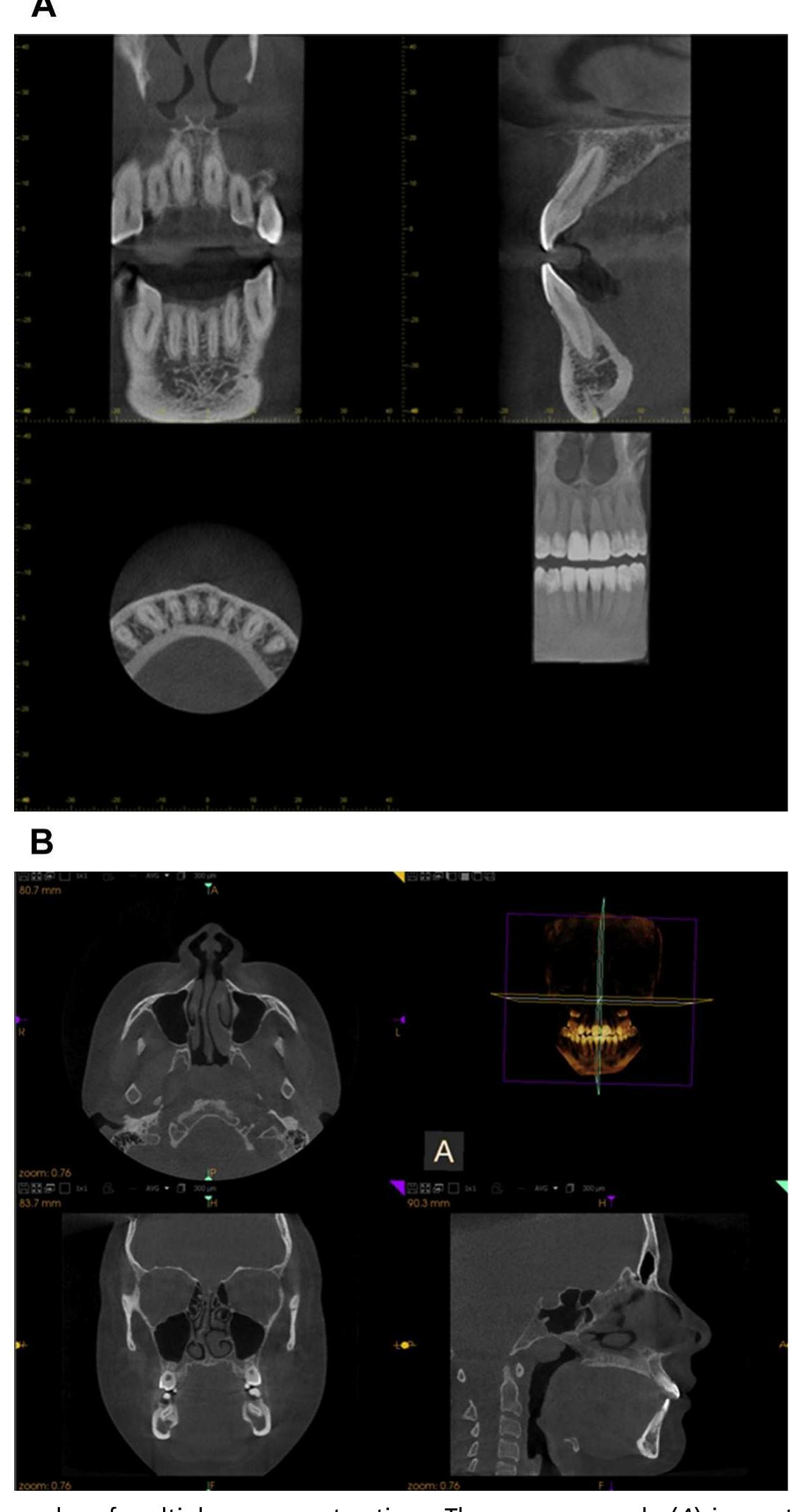 Figure 6 - Basic Principles of Cone Beam Computed Tomography