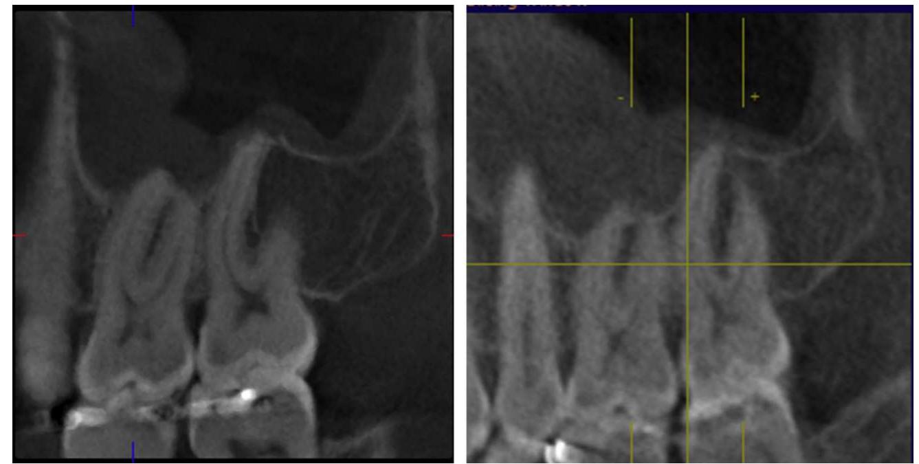 (PDF) Basic Principles of Cone Beam Computed Tomography