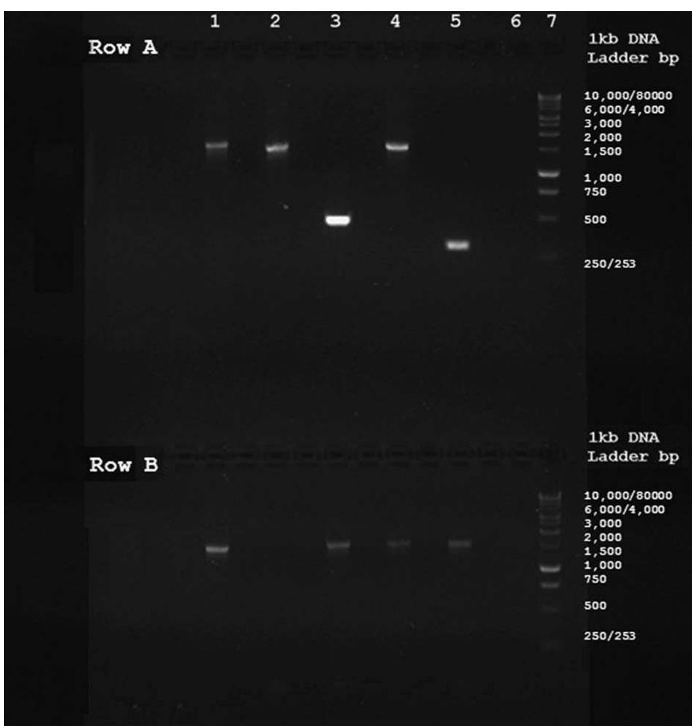 Gel electrophoresis of pcr amplification products with