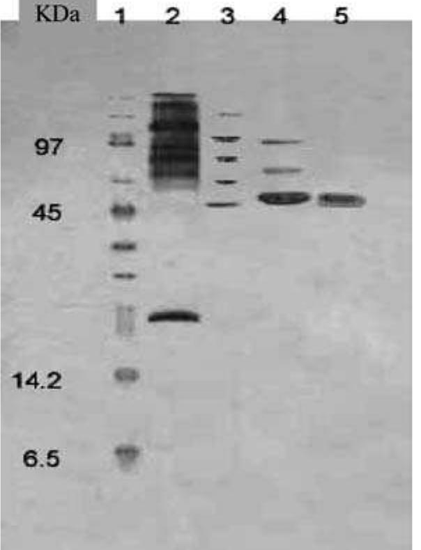 PDF) Purification and characterization of lignin peroxidase