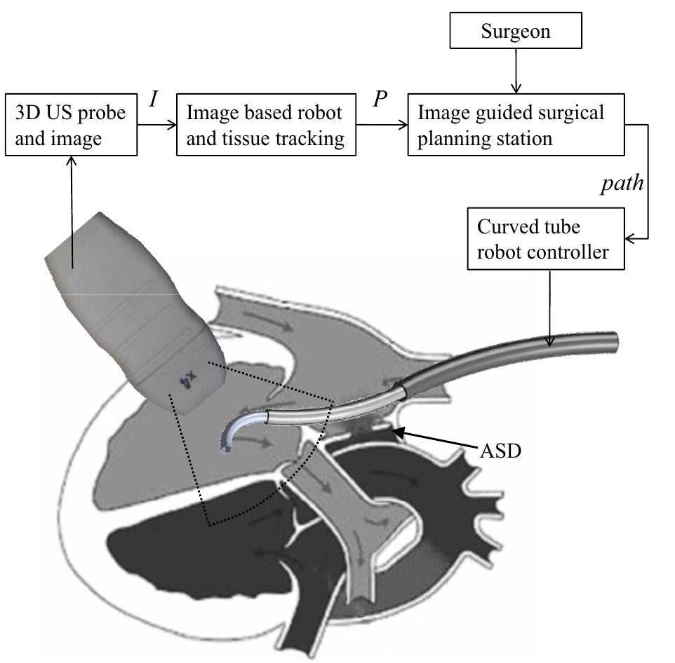 Figure 1 - from Detection of curved robots using 3D