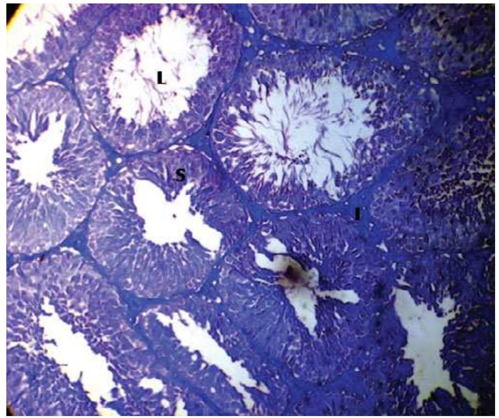 Photomicrograph of testis stained with l. cyanescens. ph: