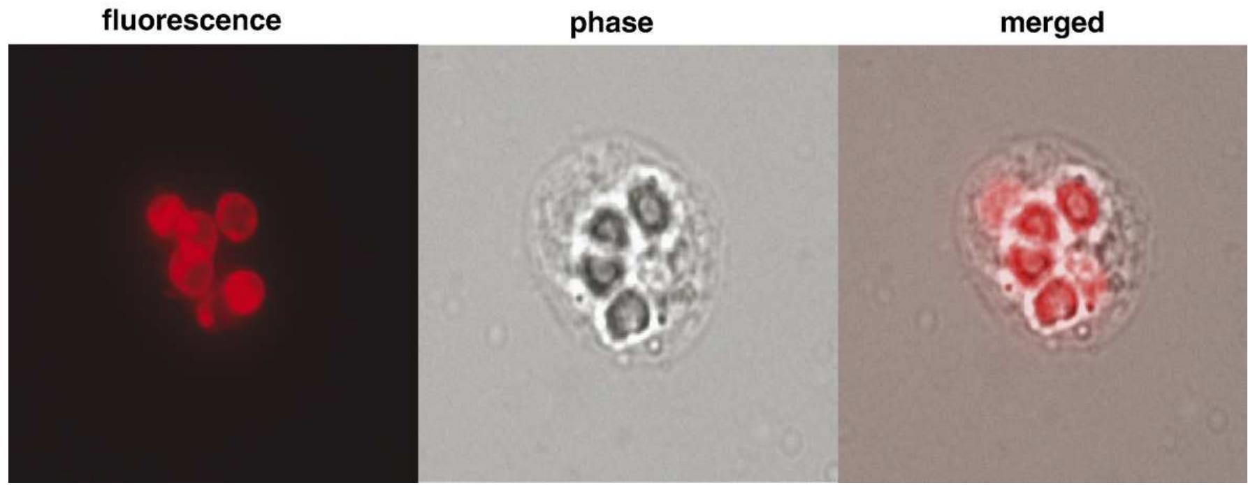 Phase Contrast Rbcs Photomicrographs of a single thp-1 cell with phagocytosed