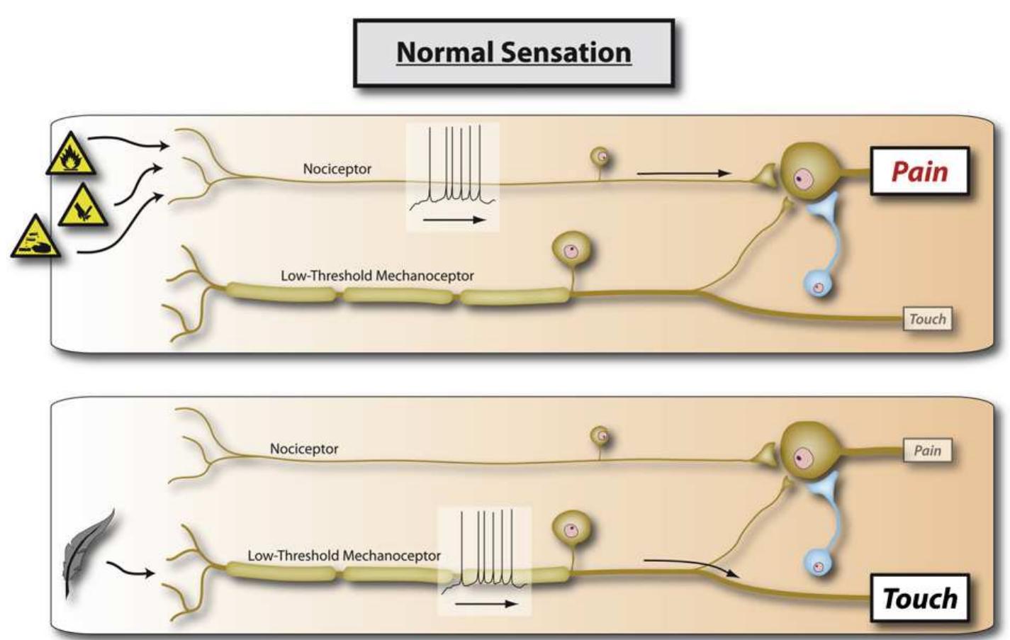 (PDF) Woolf 2011 Central sensitization