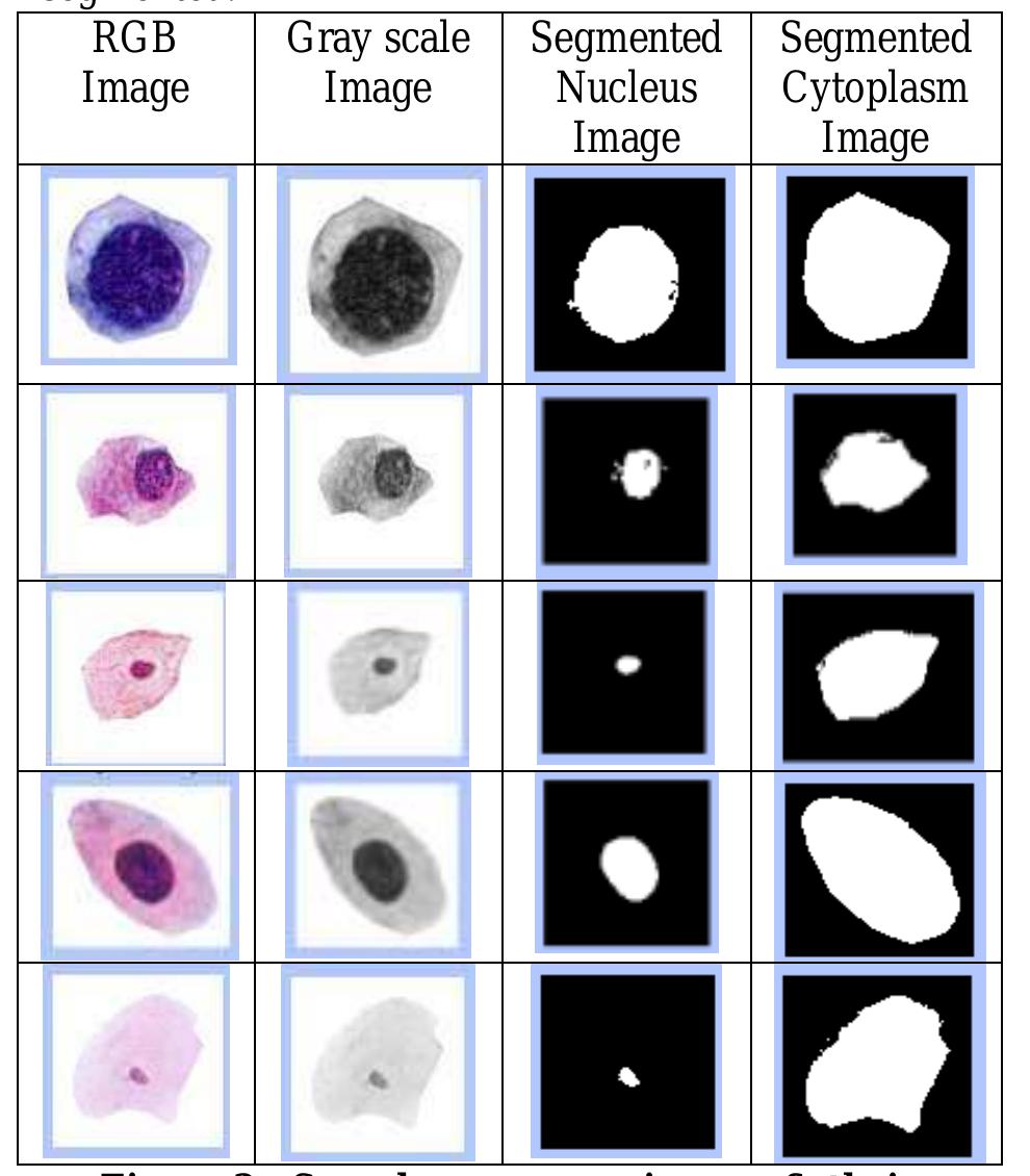 Figure 1 - from Pap Smear Images Classification for Early