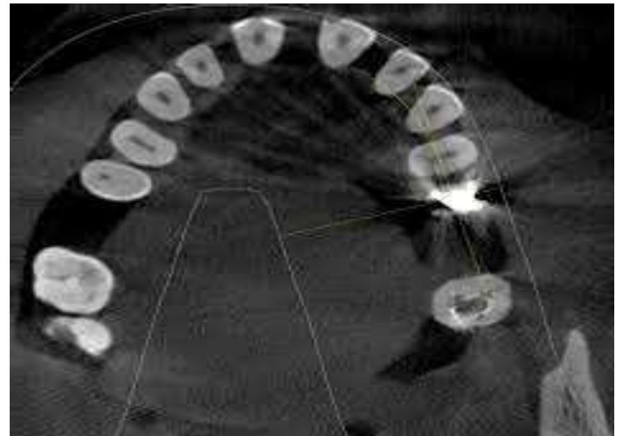 Figure 1 - from Understanding artifacts in cone beam