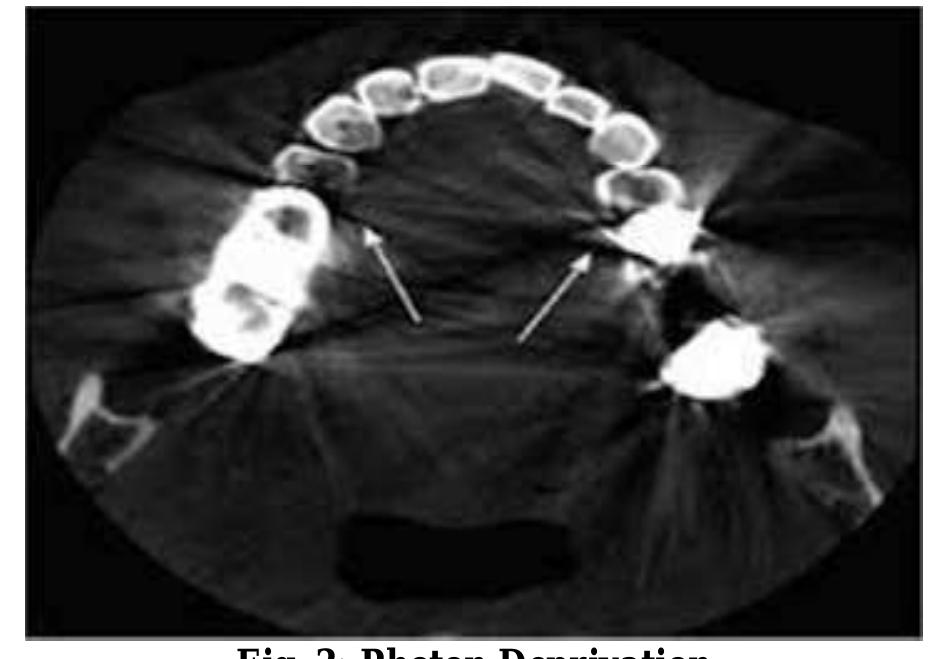 Figure 3 - Understanding artifacts in cone beam computed