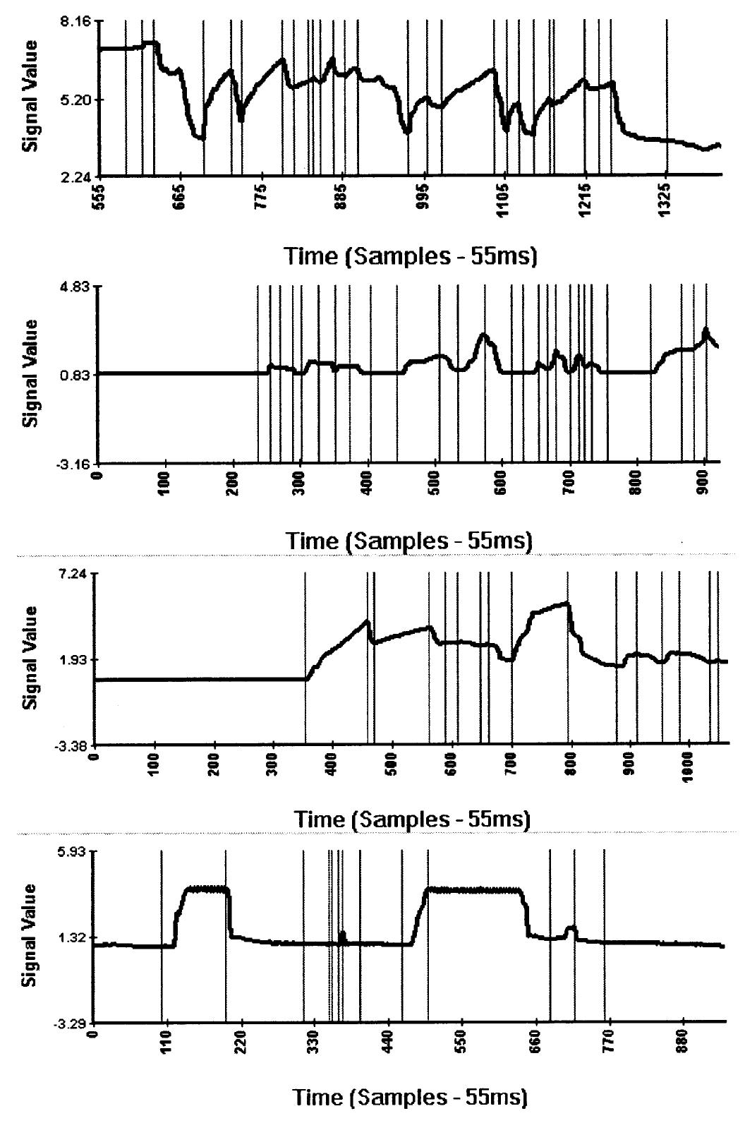 Four examples of the automatic segmentation algorithm