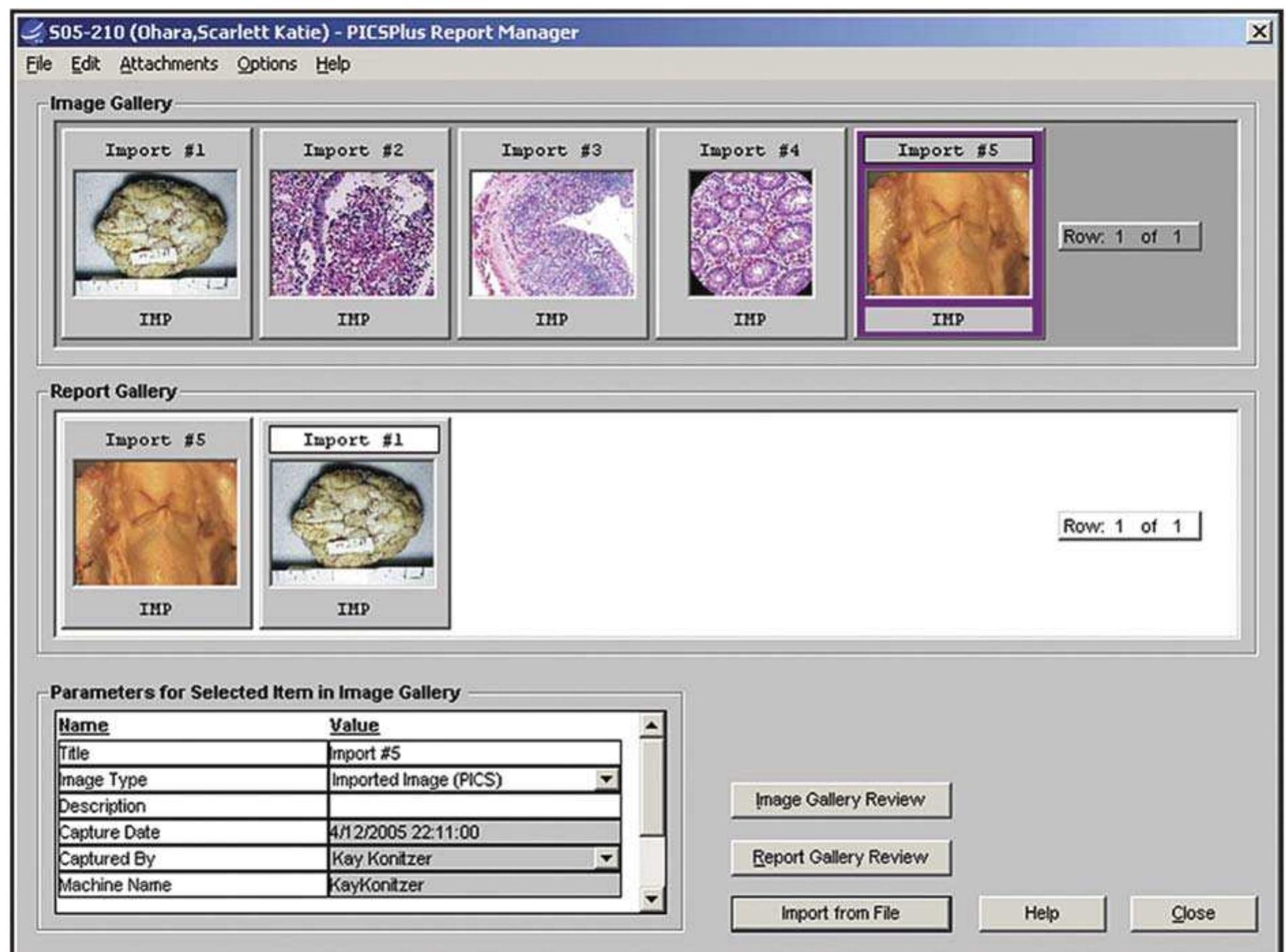 (PDF) Anatomic Pathology Laboratory Information Systems