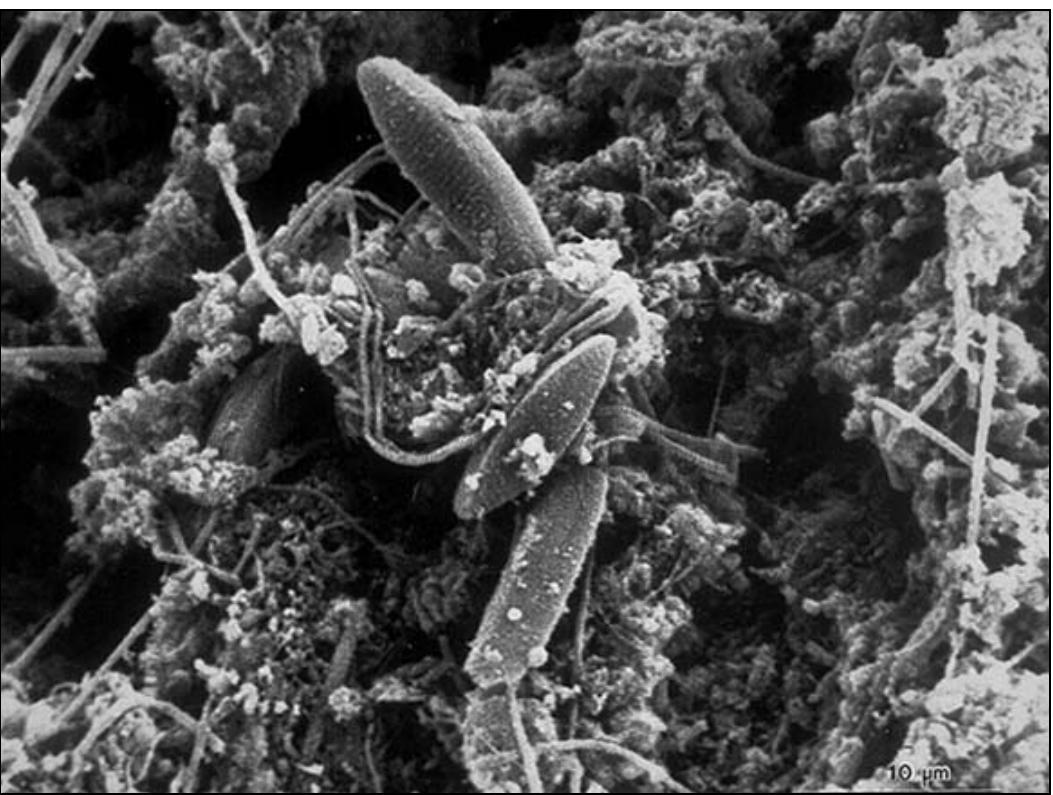 Scanning electron micrograph of a native biofilm that devel-