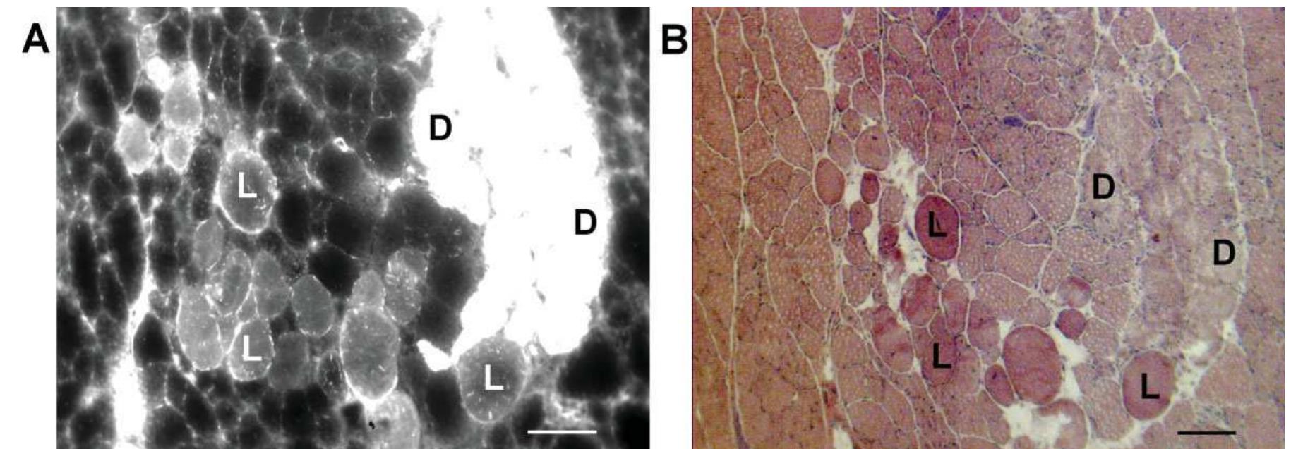 (PDF) Use of evans blue dye to compare limb muscles in exercised young ...