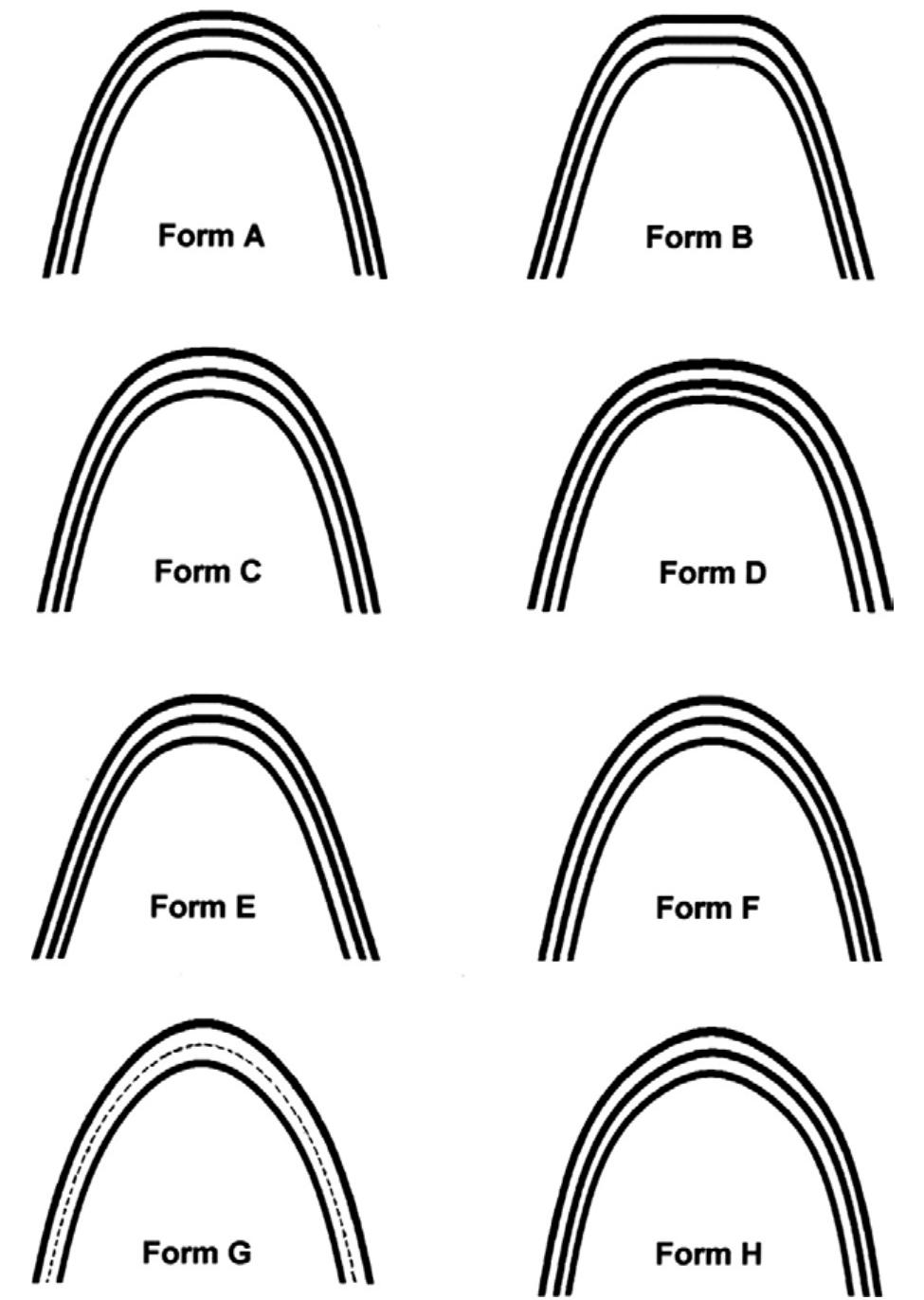 (PDF) A new concept of mandibular dental arch forms with normal occlusion