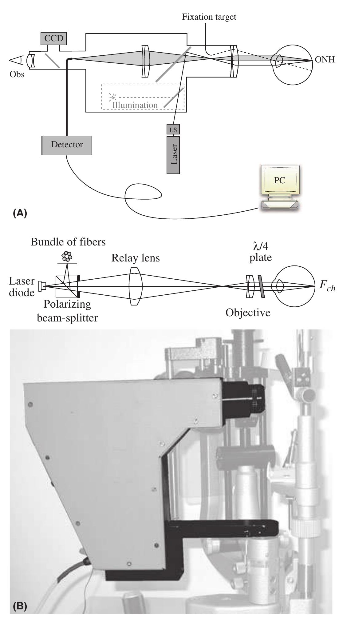 (PDF) Ocular blood flow assessment using continuous laser Doppler flowmetry