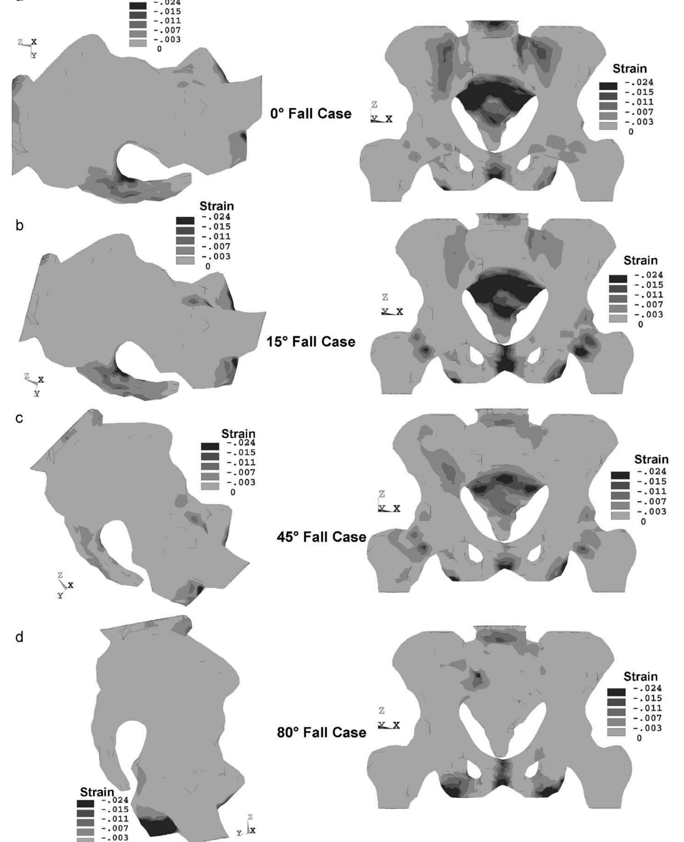 Three-dimensional view of (a) the fe model of