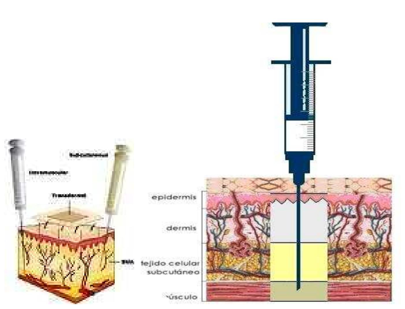 Extravascular Injection (PDF) JOURNAL OF DRUG DELIVERY RESEARCH A REVIEW: PARENTRAL DEPOT DRUG ...