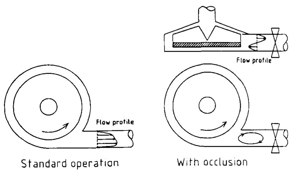 The schematic drawings show the complexity of flow profiles
