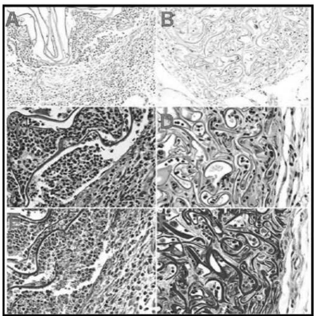 Histology of ip implants: wright’s stain (original