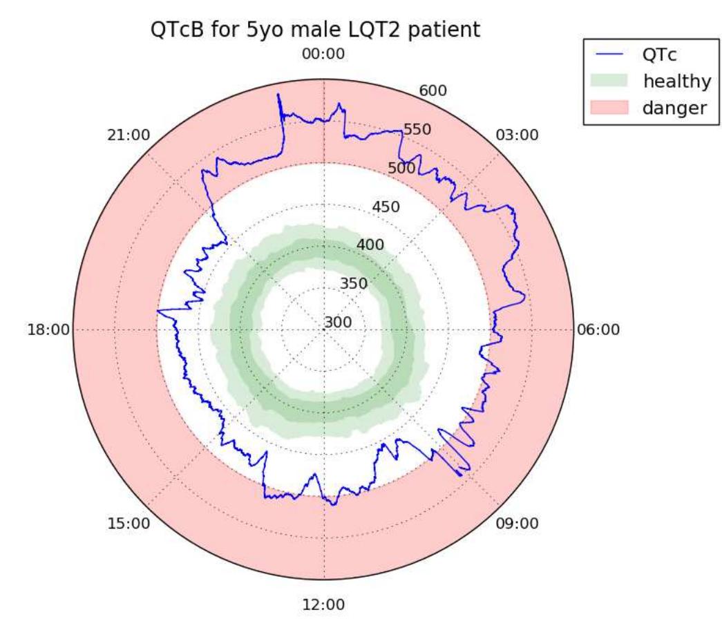 Example 24-hour qtc plot in the “ecg clock” format [81]. qtc