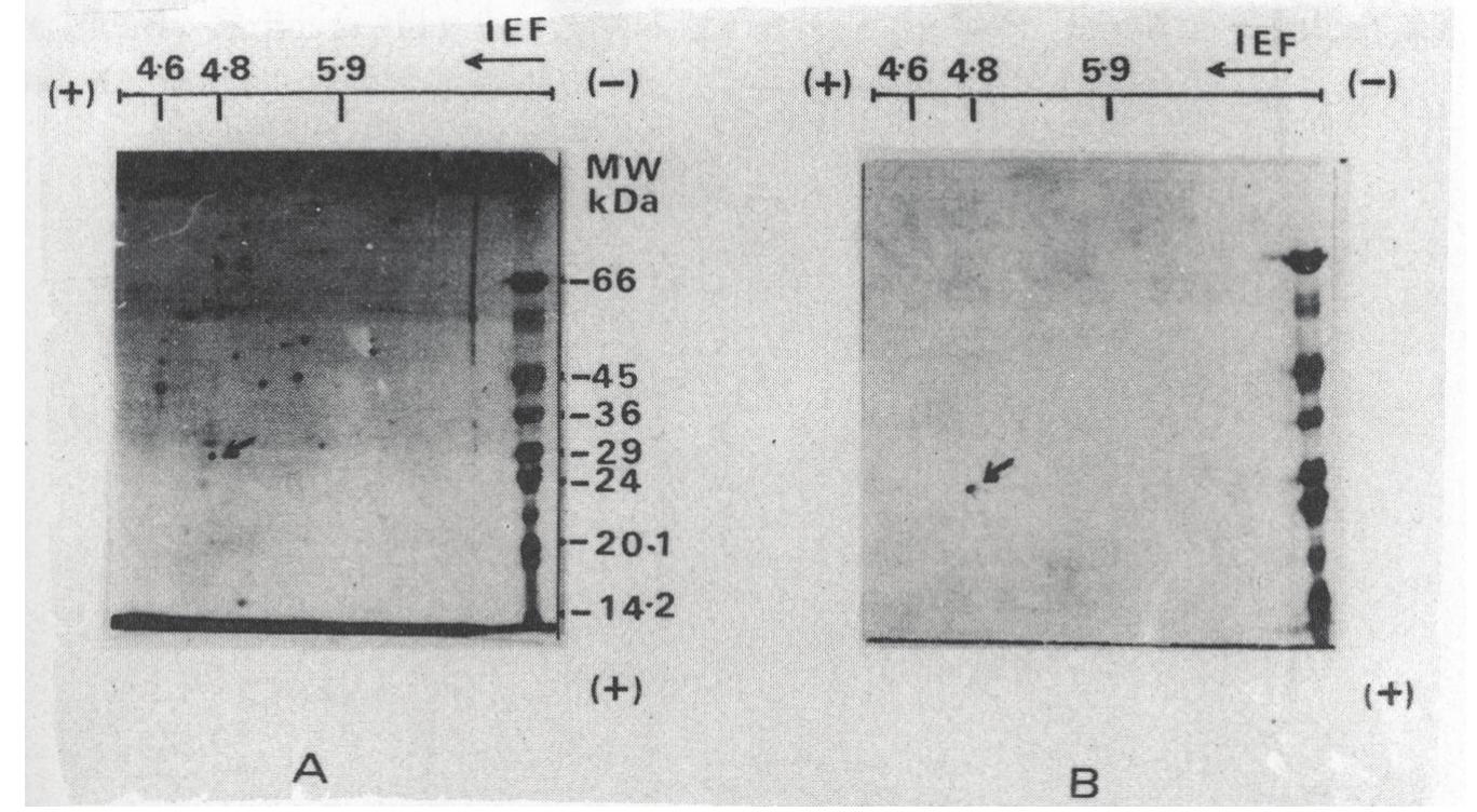 Two-dimensional gel electrophoresis of proteins from total