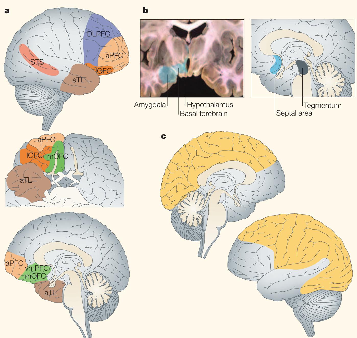 (PDF) The neural basis of human moral cognition