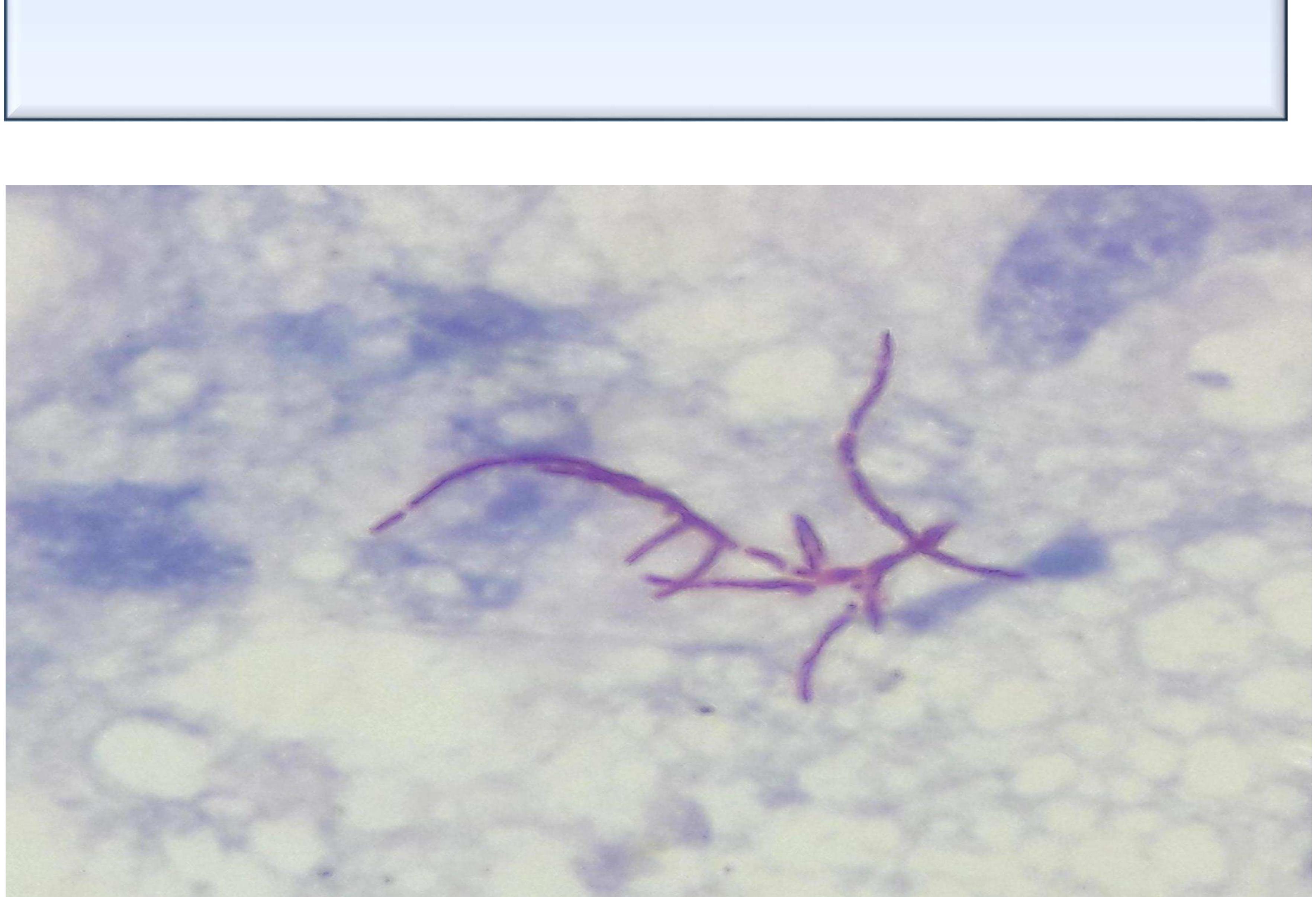 Tor Staining Rus trom sud-cutaneous adscess was received tor gram stain