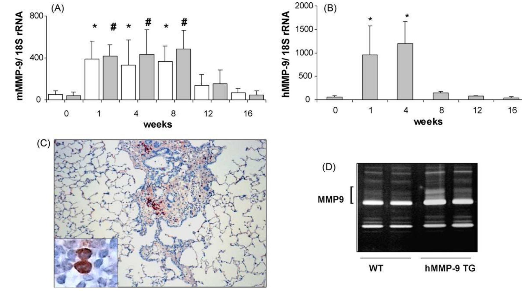 Figure 1 - from Overexpression of MMP9 in macrophages