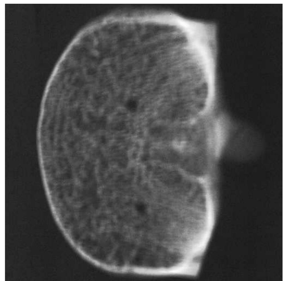 Image of transverse section of vertebral bone taken at 50