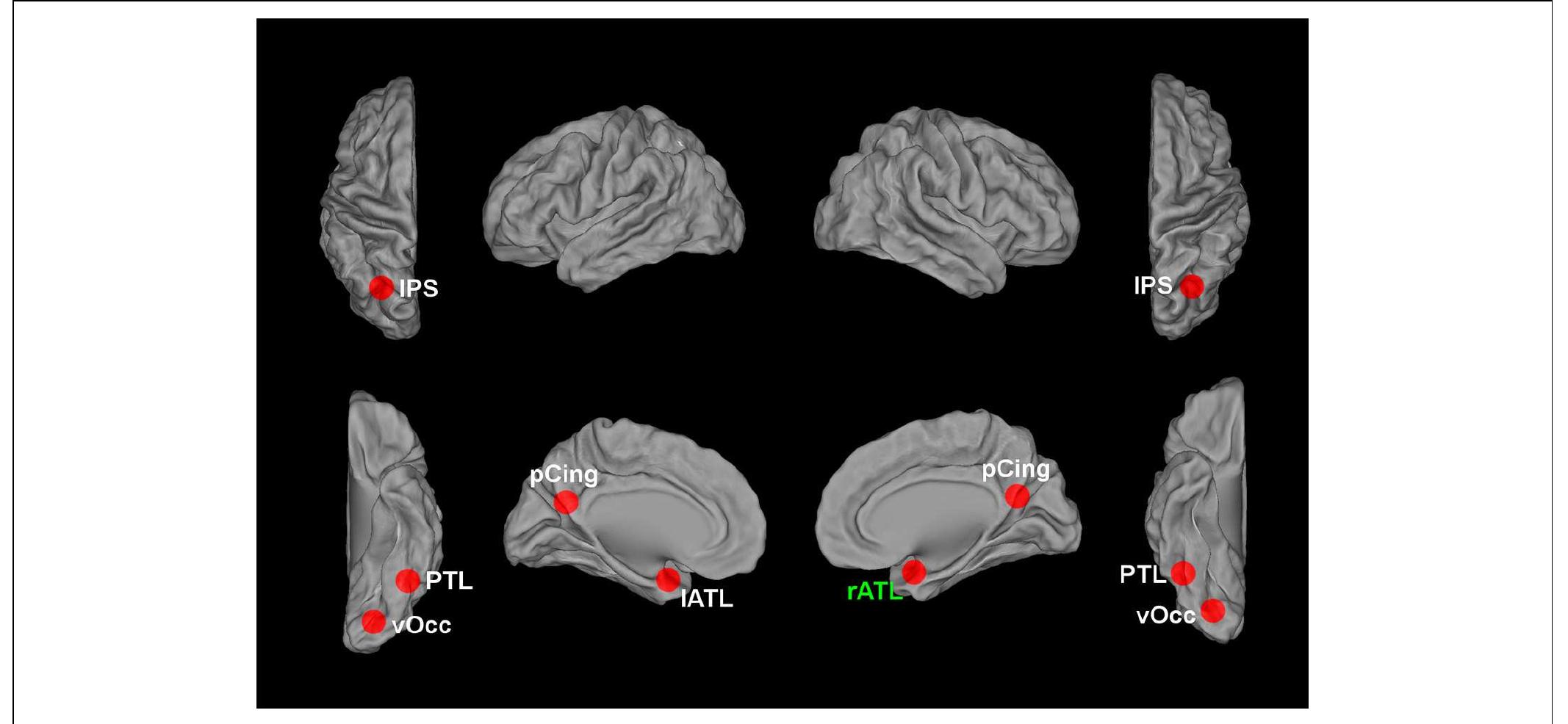 Figure 1 - from The neural mechanisms for the recognition of
