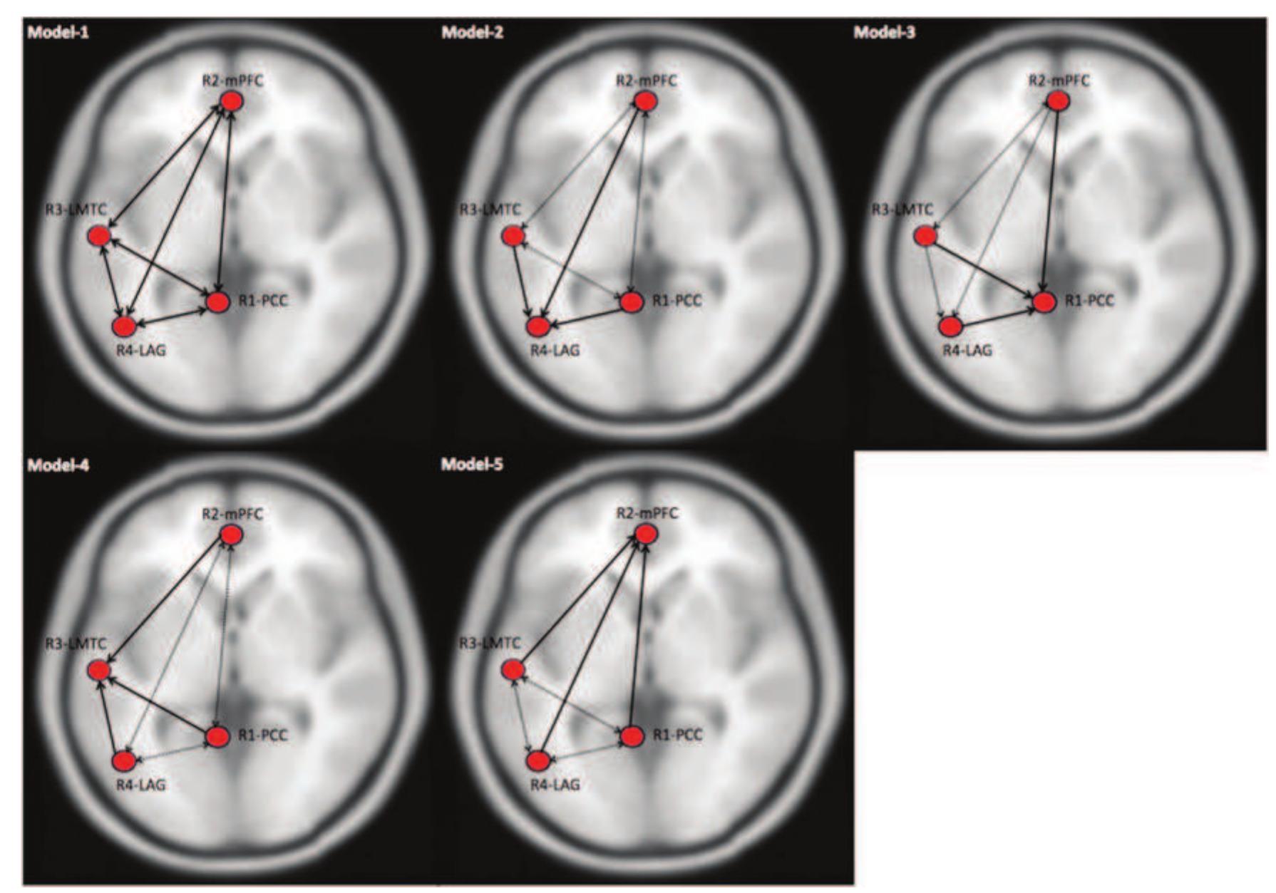 Defining a model space for dcm analysis. a base-model