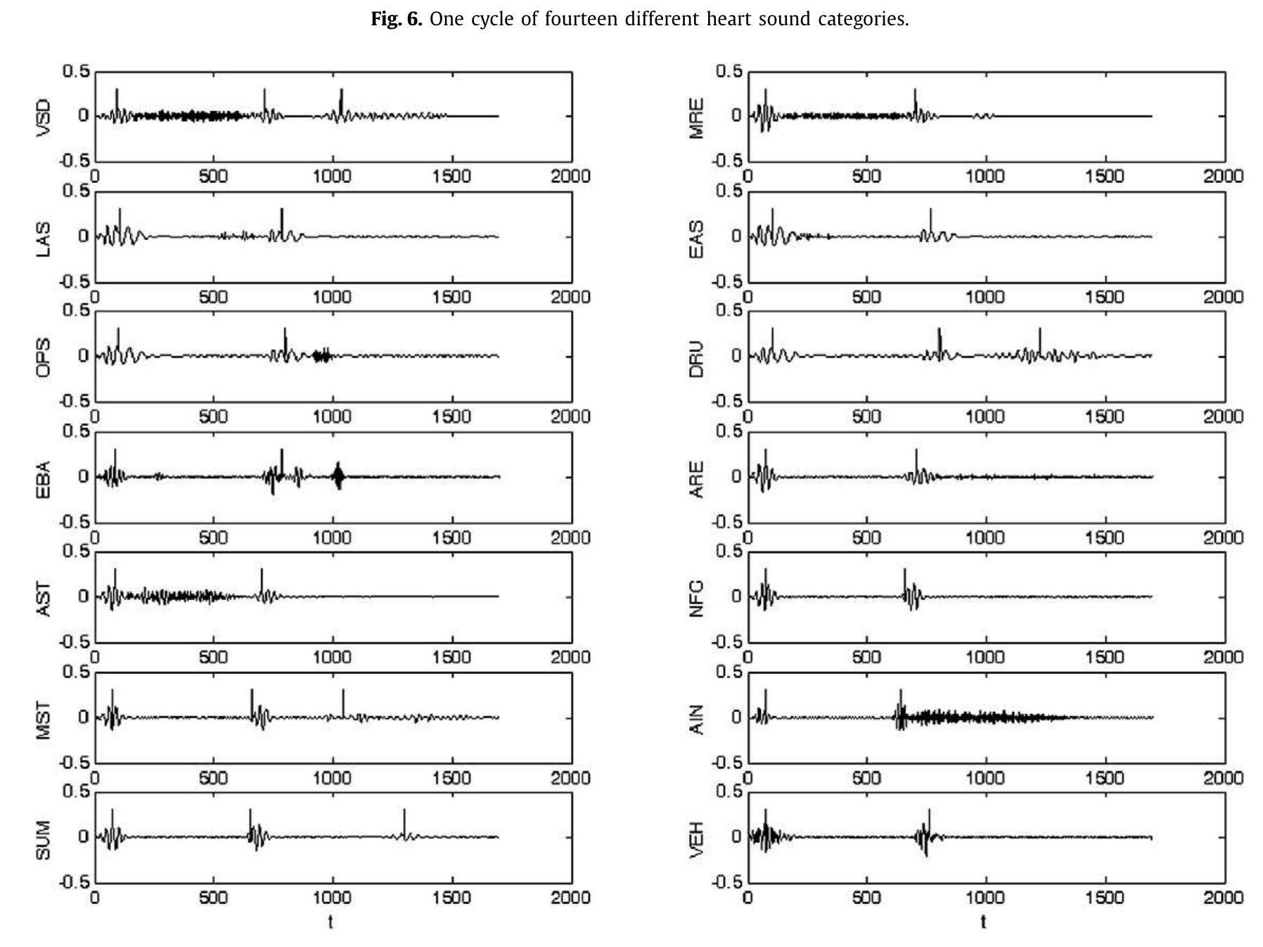 (PDF) Heart sound classification using wavelet transform and ...