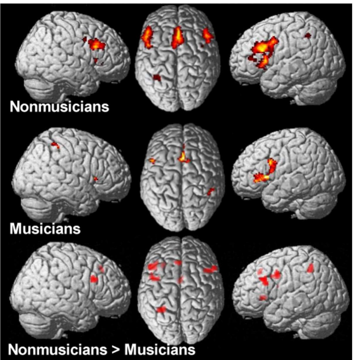 (PDF) Neural Correlates of Rapid Spectrotemporal Processing in ...