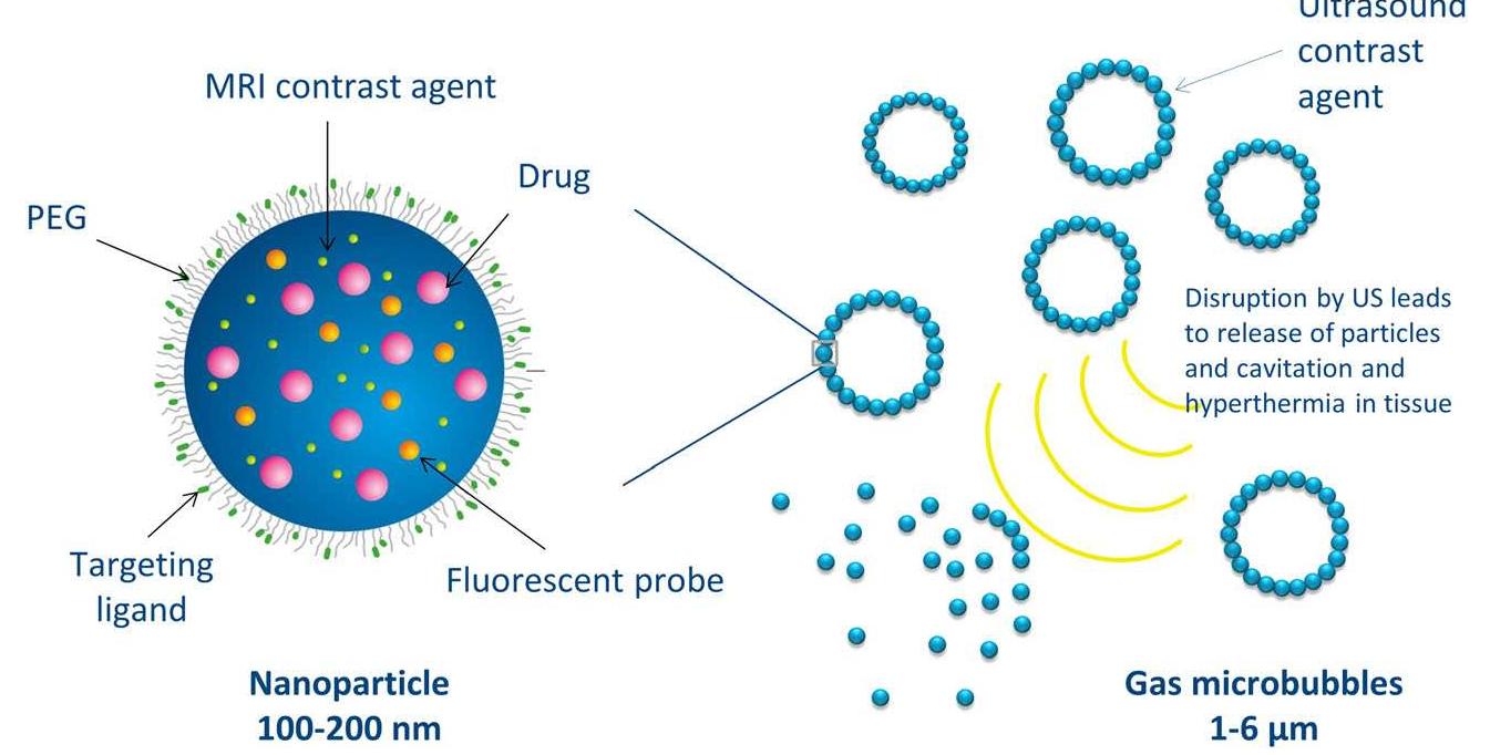 Schematic presentation of ultrasound-mediated delivery of