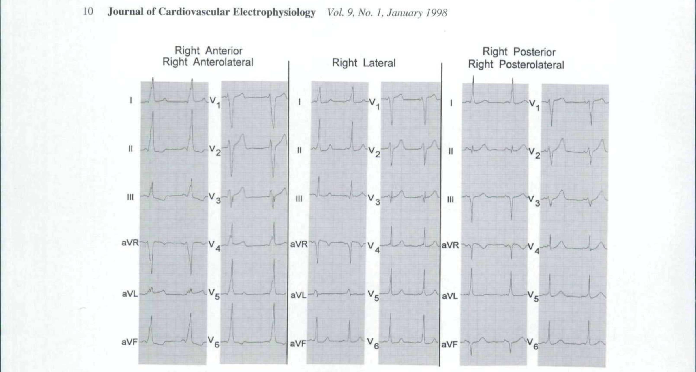 Figure 7 - from Development and Validation of an ECG