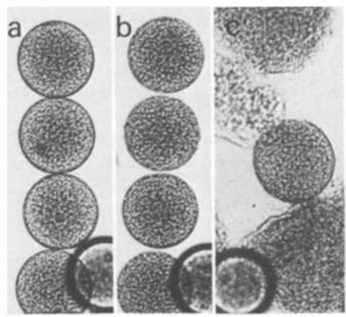 Alignment Rear Egg Figure 2 - from Cytodifferentiation to tracheary elements