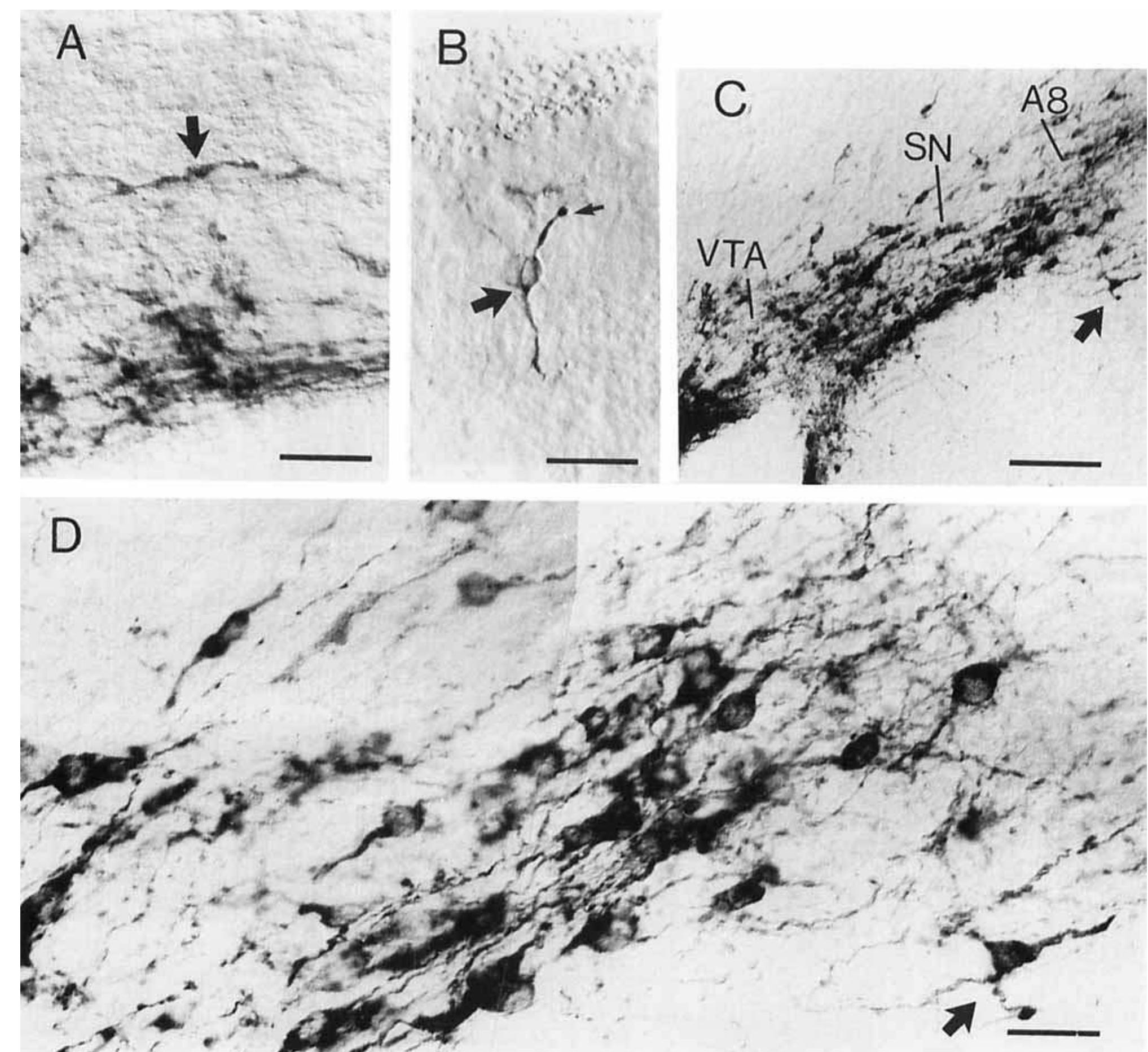 Photomicrographs of sagittal sections of the brain at $40,