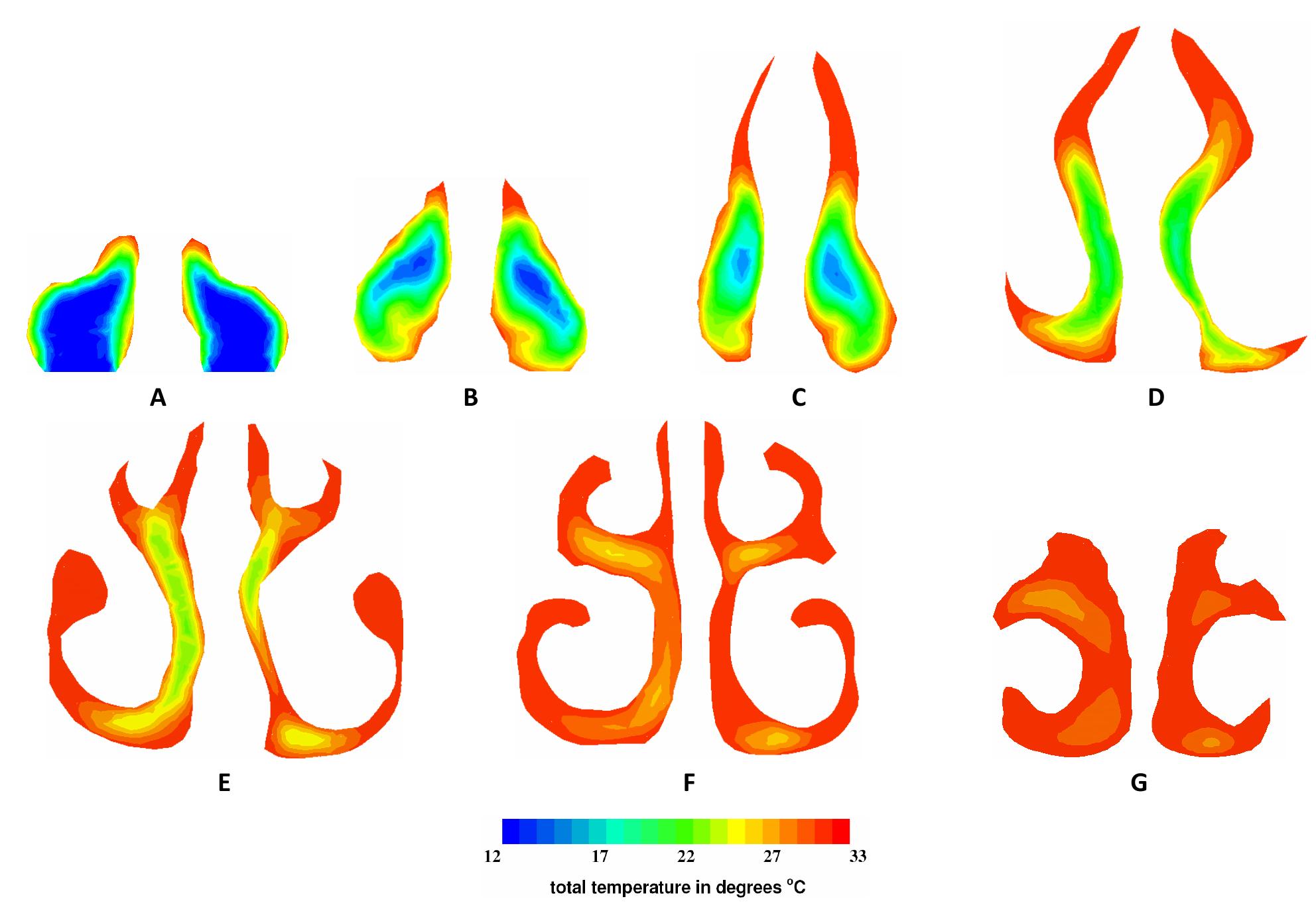 Contours of total temperature at cross-sections throughout