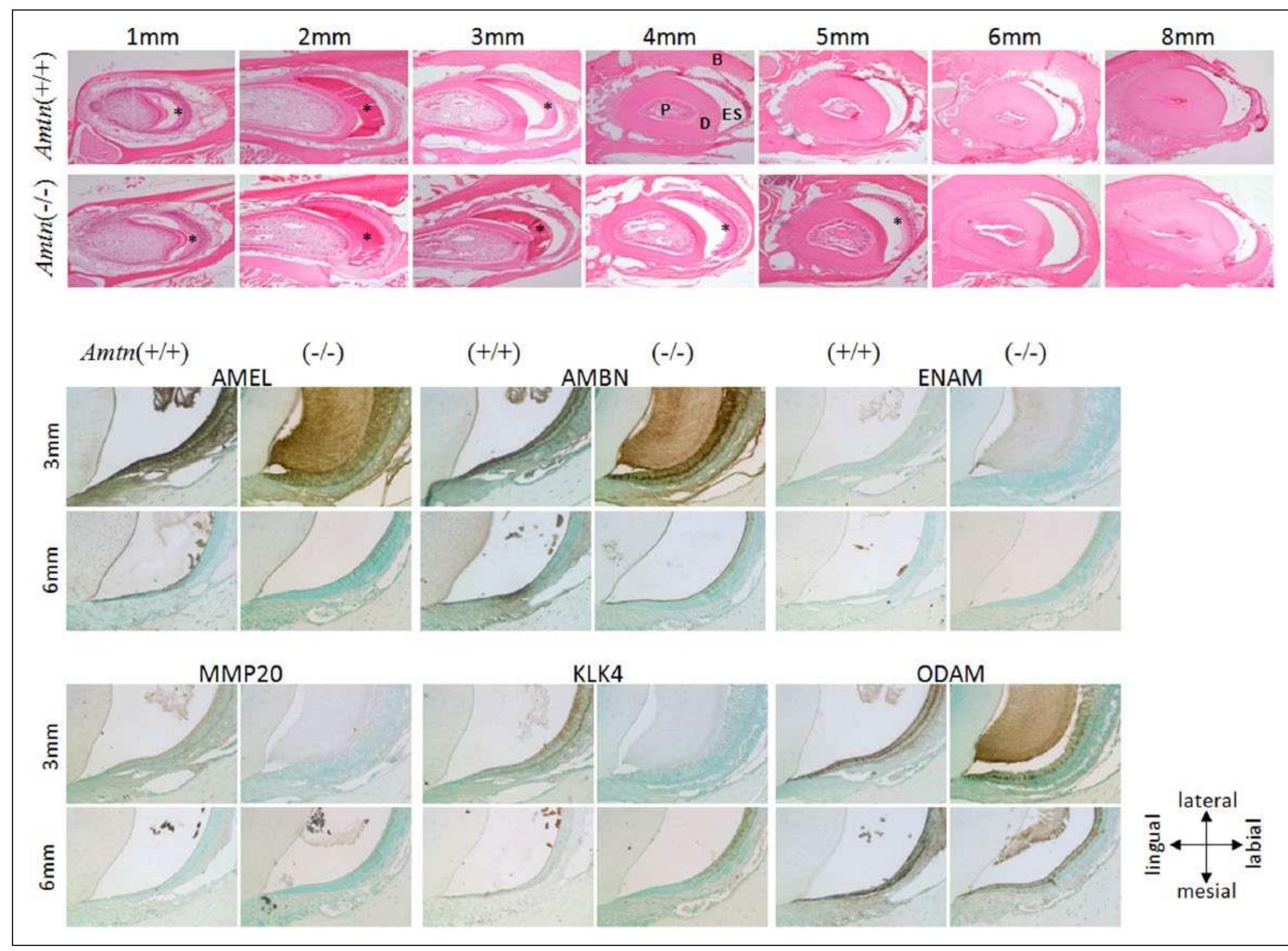 (PDF) Enamel Hypomineralization and Structural Defects in Amelotin ...