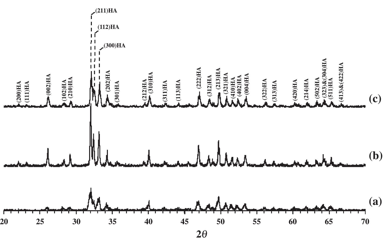 Typical xrd pattern of synthetised hydroxyapatite
